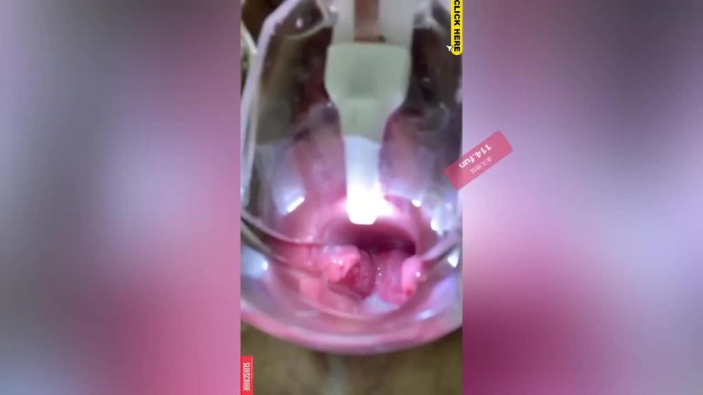 【自虐淫穴】重口变态少女自虐骚逼 烂逼塞蛋 抽插扩张勐捅 淫语不断 预览截图 1
