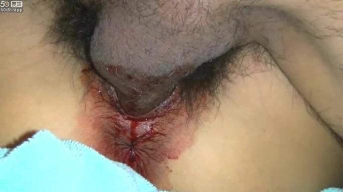 （破处）全网最真实破处大学生被大款包养第一次流了好多血 预览截图 11