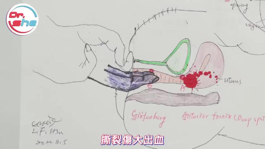 #DrShe许蓝方#G点到底在哪里女生四大高潮点一次教会你!这些就是男人一生都在追寻的点! 预览截图 10