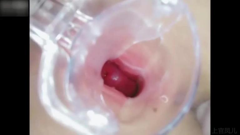 可爱萝莉用扩音器撑开阴道观看内部结构 预览截图 3