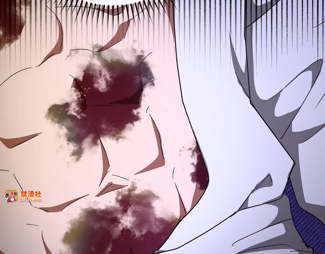 第81话 僵人综合征 第 45 页